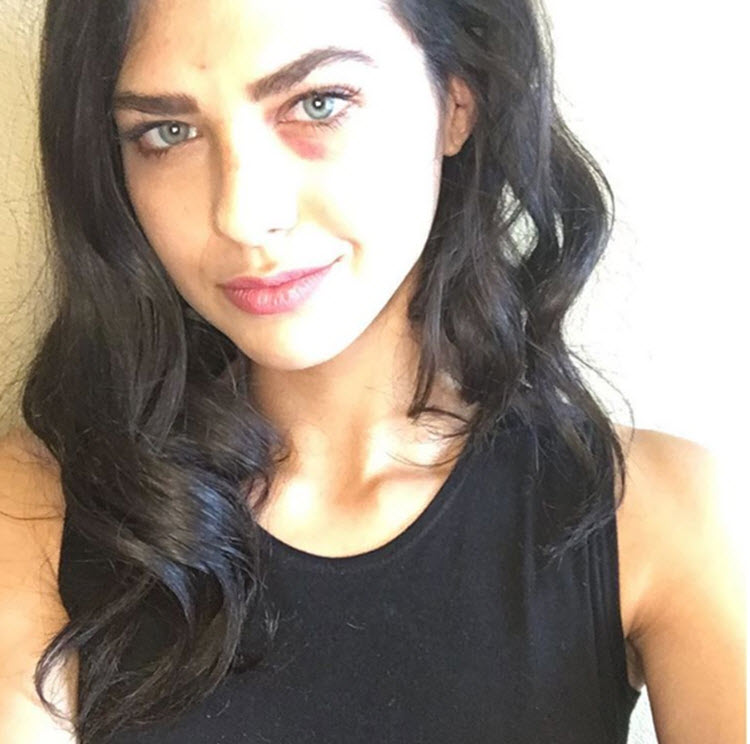 Fotomodel krijgt Inspire 1 drone in gezicht